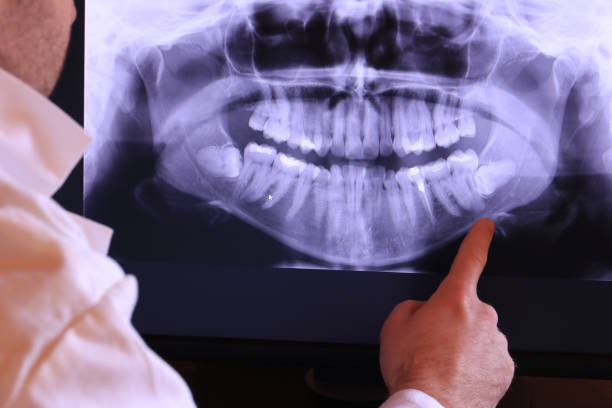Best Emergency Dentist for Knocked-Out Tooth in Marshall, MI