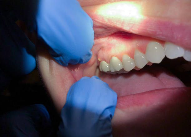 Best Orthodontic Emergency Dentist in Marshall, MI
